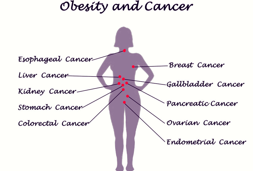 Obesity-Related Cancers and Implementing Behavioral Change